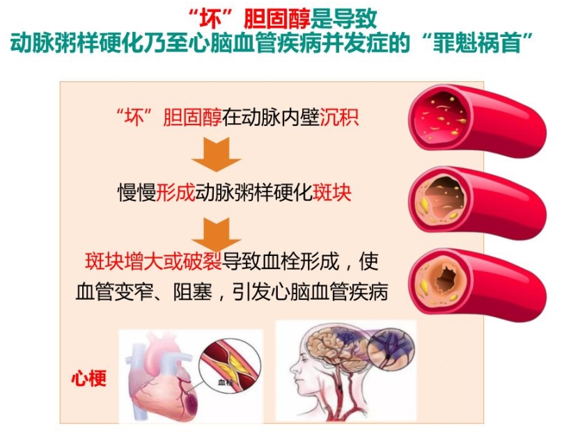 光明卫生·科普脱口秀|黄恺：糖心共管，减少代谢异常患者的心血管事件