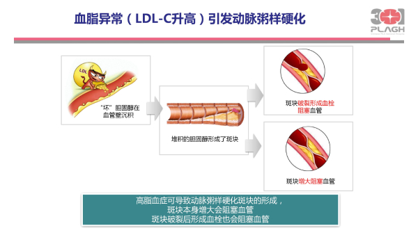 光明卫生·科普脱口秀|叶平：血脂异常，不仅仅是化验单上的箭头朝向