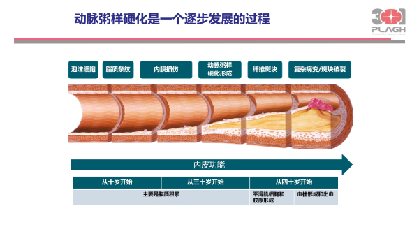 光明卫生·科普脱口秀|叶平：血脂异常，不仅仅是化验单上的箭头朝向