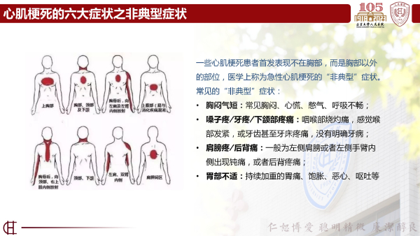 光明卫生·科普脱口秀|刘健：突发心梗牢记4步急救法，争取黄金救治120分钟