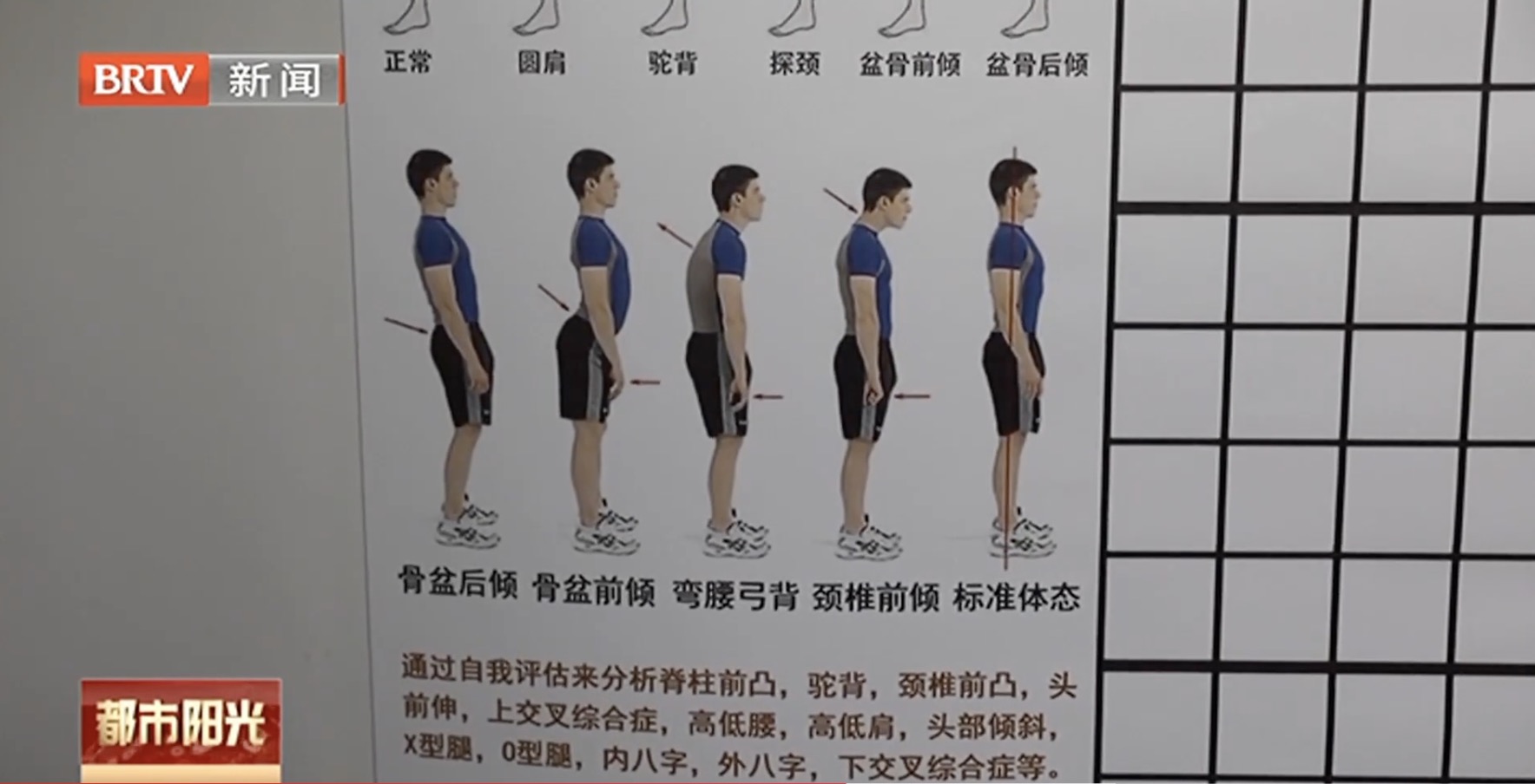 “挺起脊梁” 西城区展览路医院开设儿童青少年脊柱侧弯康复中心 “挺起脊梁” 西城区展览路医院开设儿童青少年脊柱侧弯康复中心